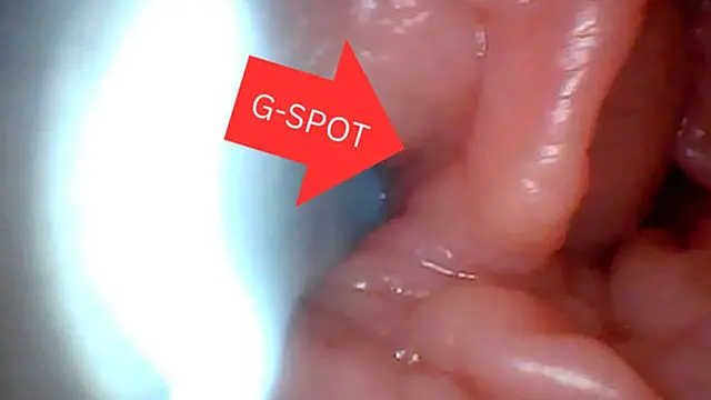 Endoscope shows G-spot up close - no penetration needed